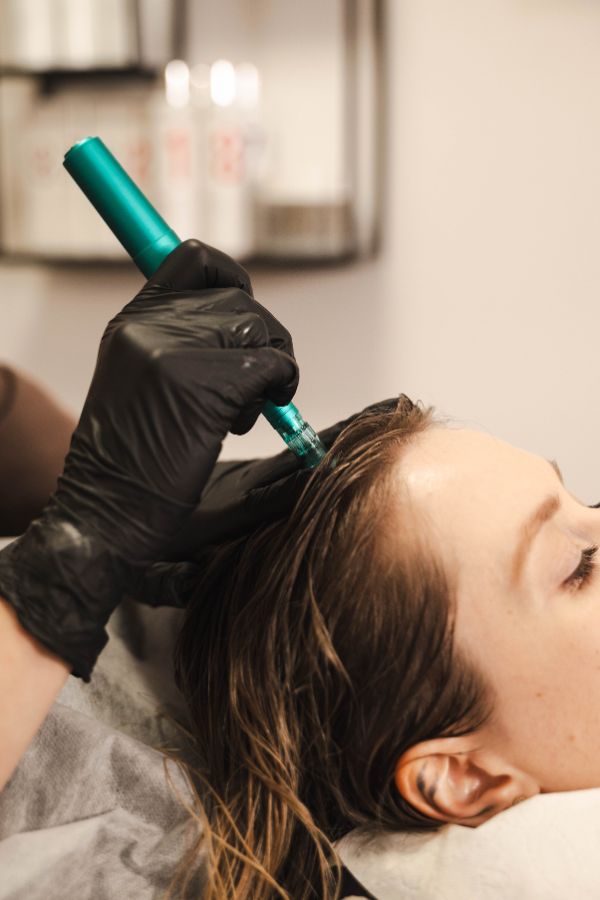 Obraz ukazuję mezoterapię mikroigłową